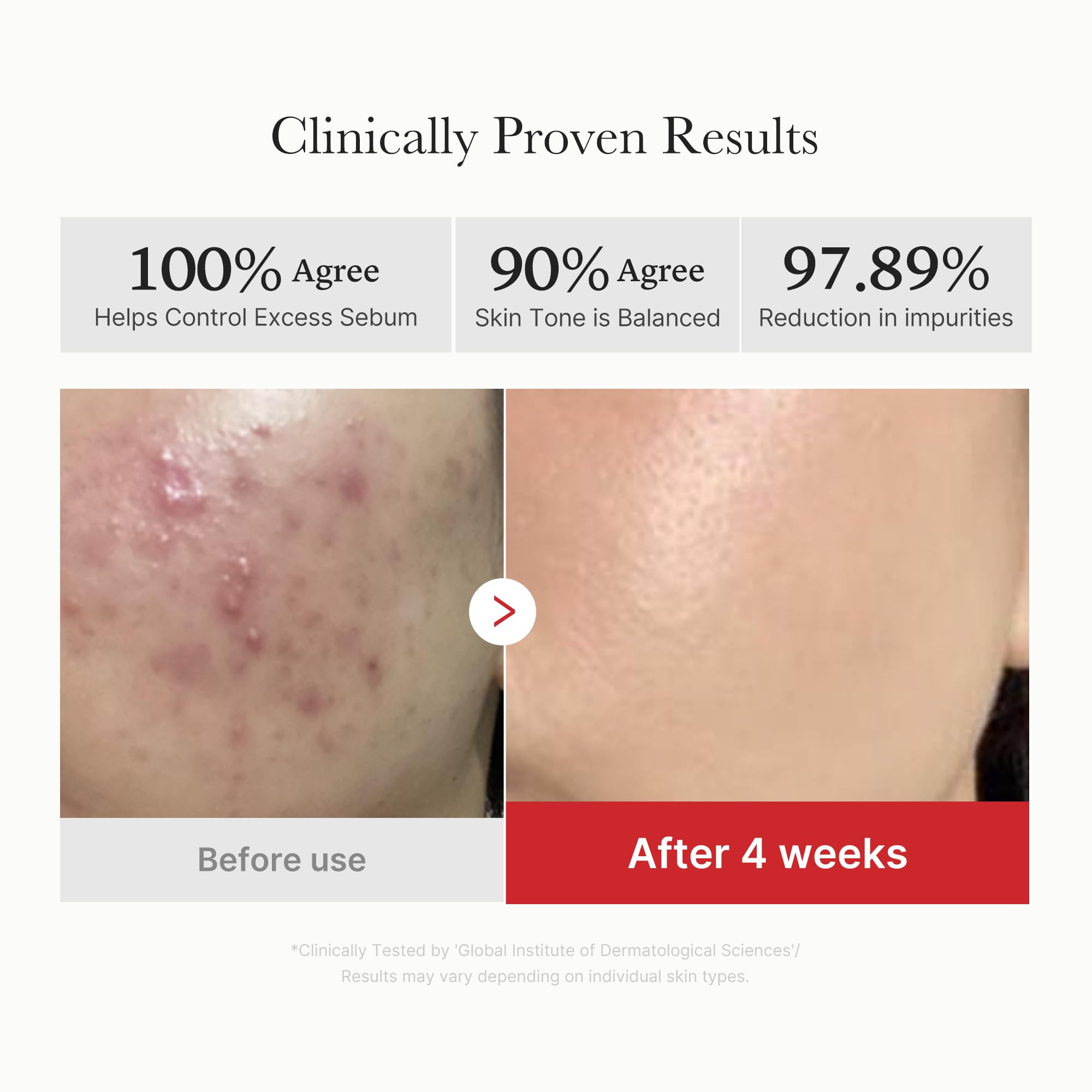 medicube Toner Pads Zero Pore Pad 2.0 | Dual-Textured Facial Pad for Exfoliation and Pore Care